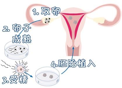 陈教授